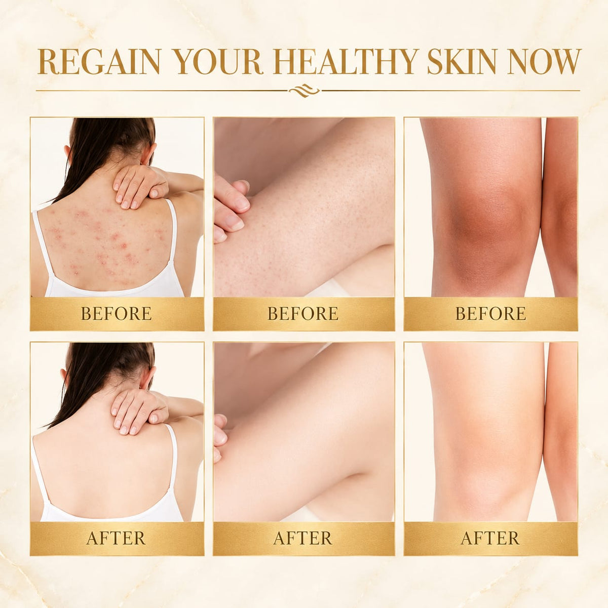 Regain your healthy skin now, before and after
